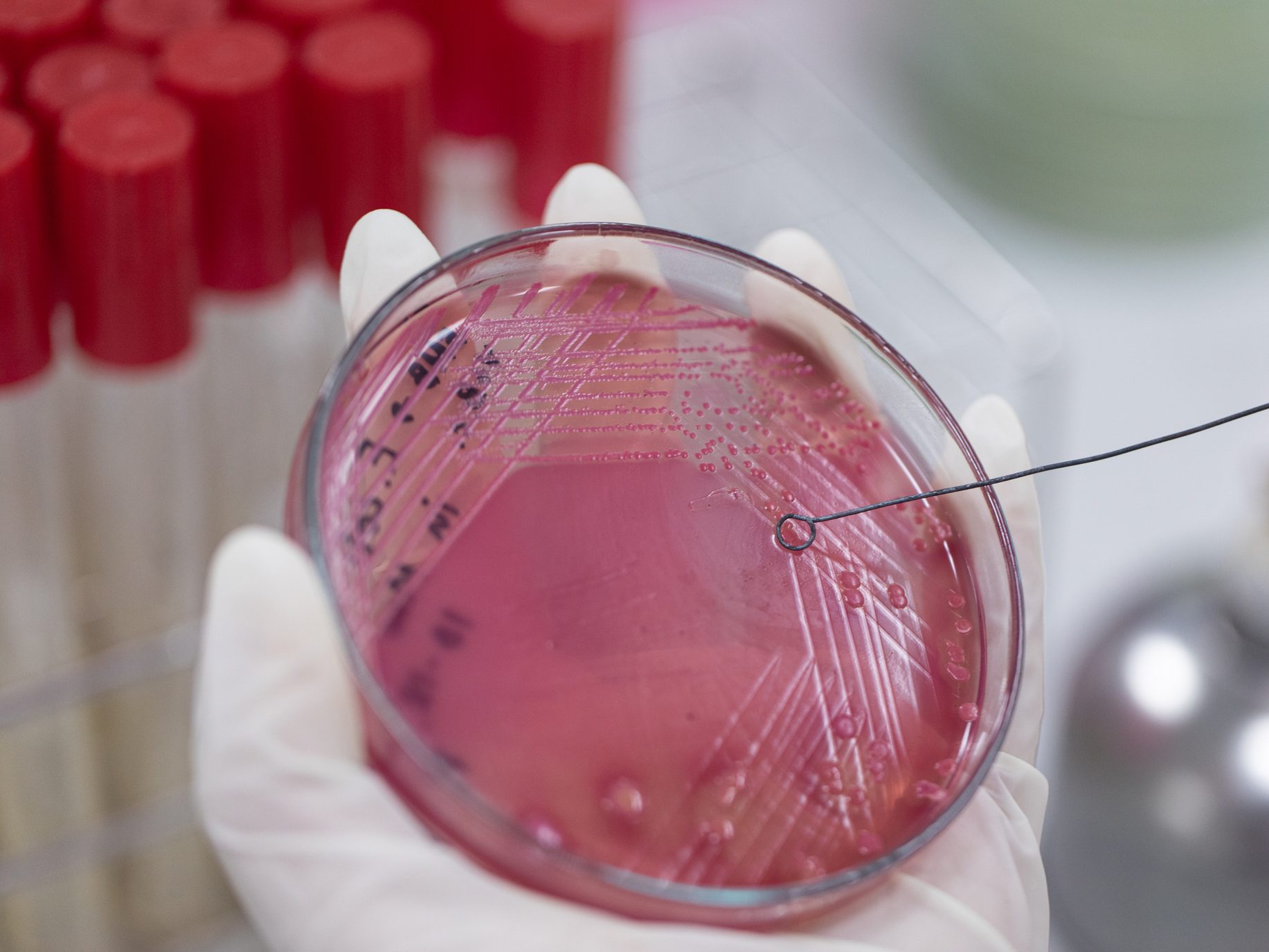Michigan Medicine: New Warnings About Superbugs