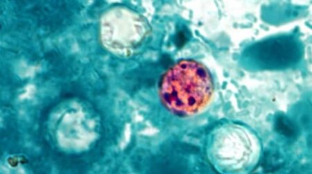 Michigan Foodborne Illness Outbreak Tops 570 Cases